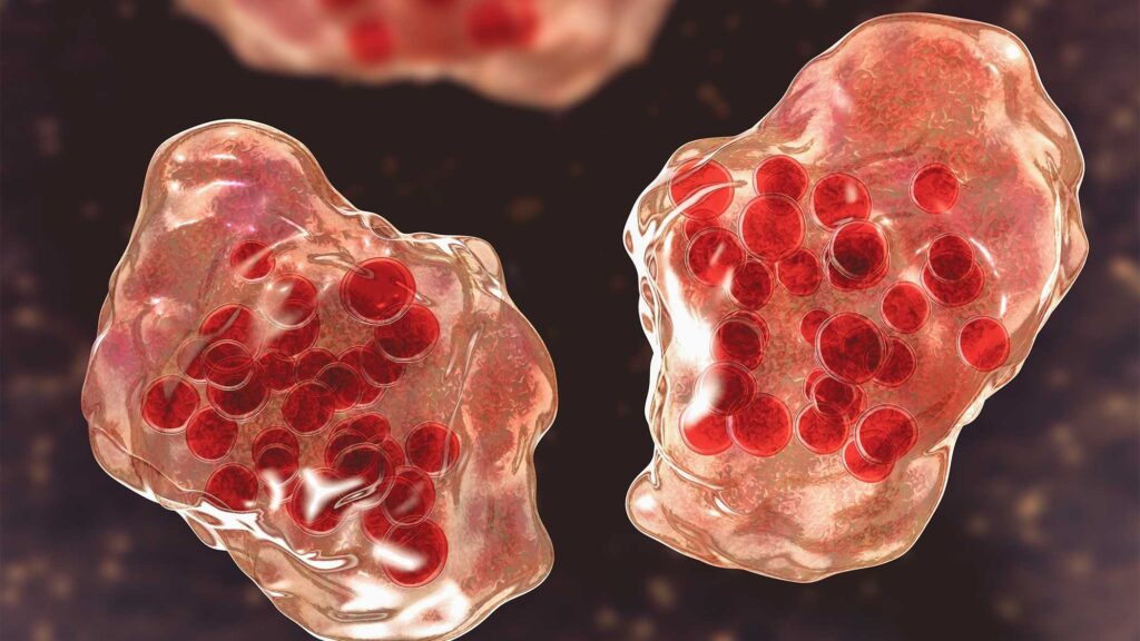 Maryland Measles Cases Rise After Travel Exposure Maryland Measles Cases Rise After Travel Exposure